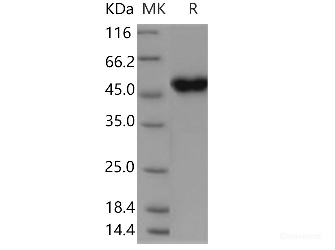 Recombinant Human CRELD1 Protein (His tag)-Elabscience