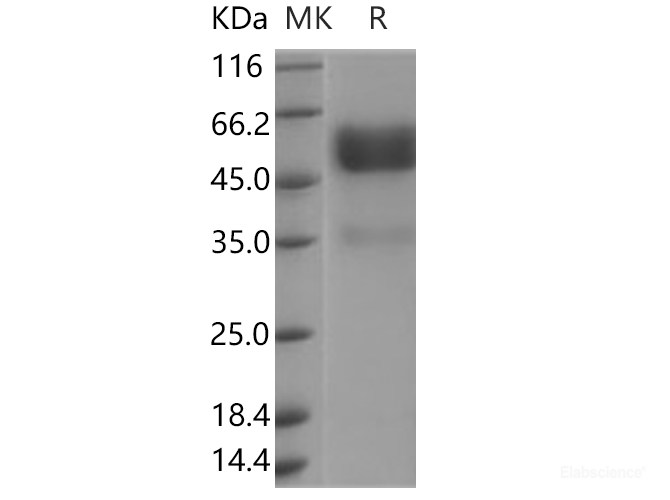 Recombinant Human TNFRSF19 / TROY Protein (Fc tag)-Elabscience