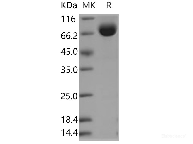 Recombinant Human LRG1 Protein (Fc tag)-Elabscience
