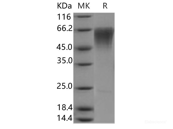 Recombinant Human CLM-9 Protein-Elabscience
