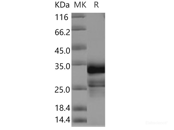 Recombinant Human CNPY4 Protein (His tag)-Elabscience