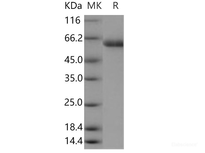 Recombinant Human sialate O-acetylesterase / SIAE Protein (His tag)-Elabscience