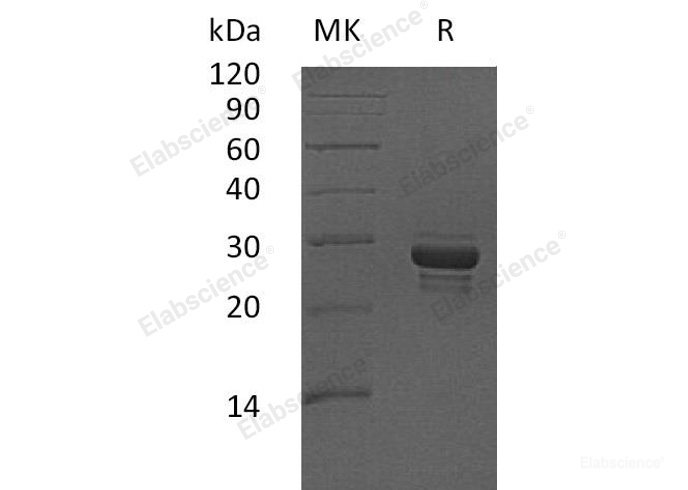 Recombinant Human CALCB Protein (Fc Tag)-Elabscience