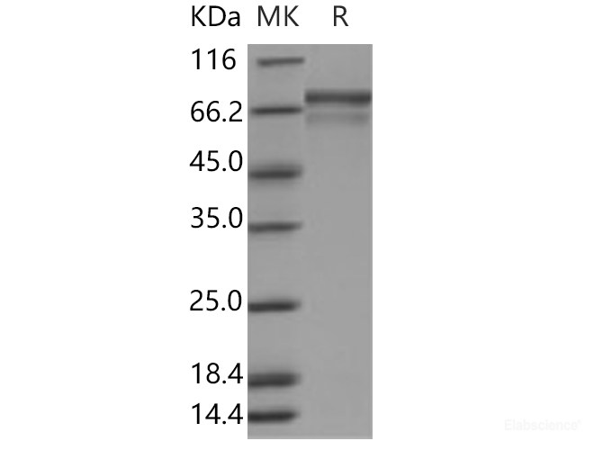 Recombinant Human PRC1 Protein (His tag)-Elabscience