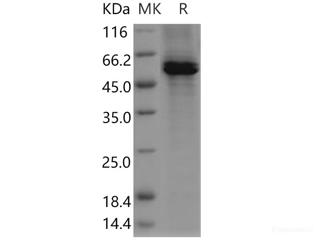 Recombinant Human AMY2A / Alpha-amylase Protein (His tag)-Elabscience