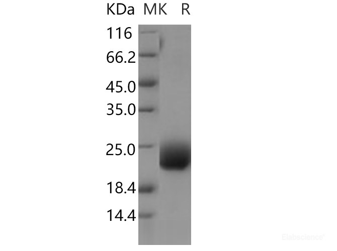 Recombinant Human CCDC47 Protein (His tag)-Elabscience