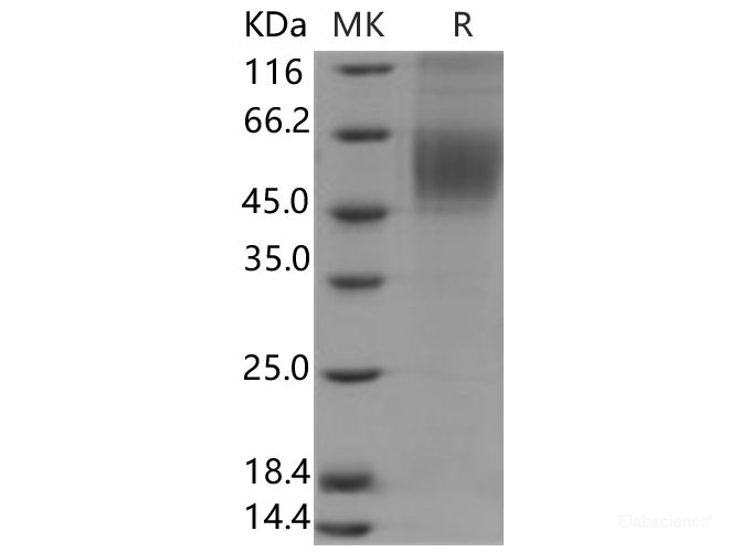 Recombinant Human CDCP1 Protein (His Tag)-Elabscience