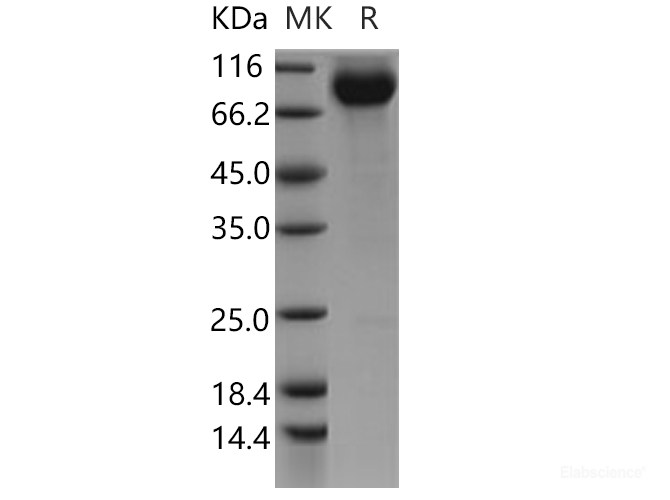 Recombinant Human CDCP1 / CD318 Protein (Fc tag)-Elabscience