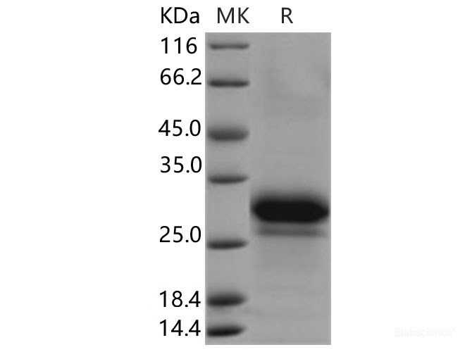 Recombinant Human FKBP7 Protein (His Tag)-Elabscience