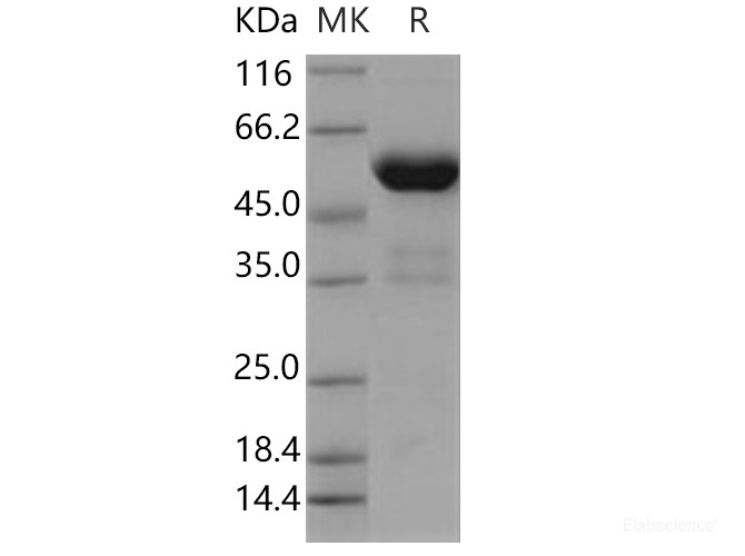 Recombinant Human PPIase / FKBP7 Protein (Fc tag)-Elabscience
