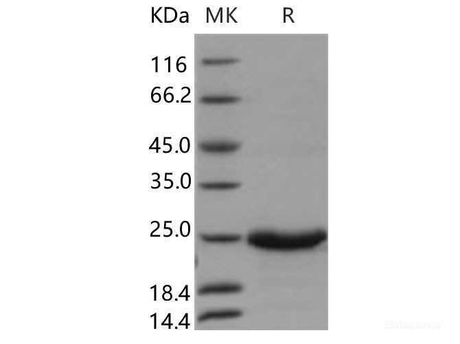 Recombinant Human GM2A Protein (His Tag)-Elabscience