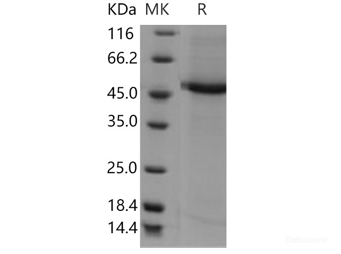 Recombinant Human CST9L / Testatin Protein (Fc tag)-Elabscience