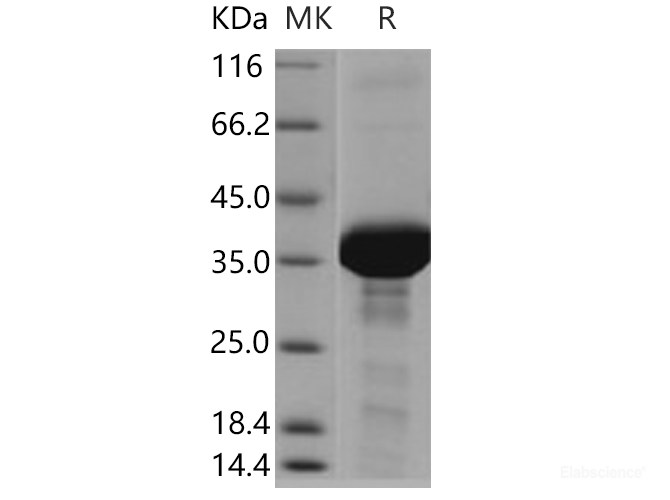 Recombinant Human FDPS Protein (His tag)-Elabscience