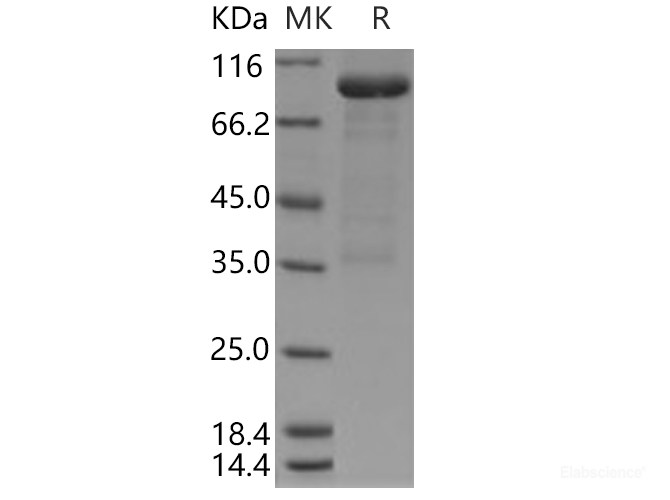 Recombinant Human LRP10 Protein (Fc tag)-Elabscience
