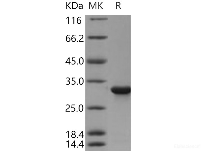 Recombinant Human CYB5R1 Protein (His tag)-Elabscience