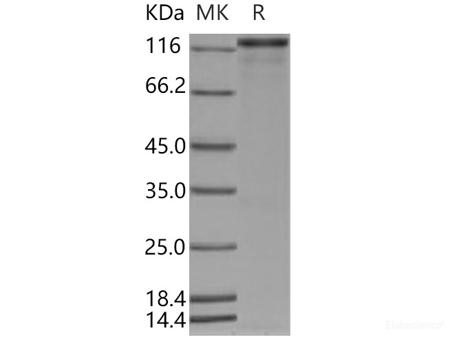 Recombinant Human P63 / TP63 / Tumor protein p63 Protein (His & GST tag)-Elabscience