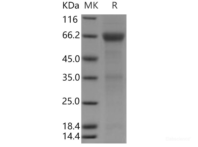 Recombinant Human ADCYAP1R1 Protein (Fc tag)-Elabscience