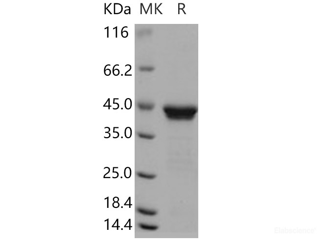 Recombinant Human RRM2B / P53R2 Protein (His tag)-Elabscience