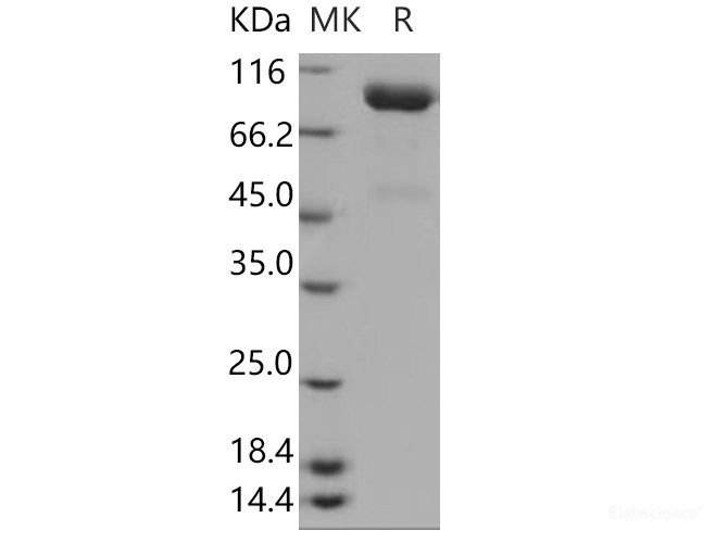 Recombinant Human SLITRK4 / Slitrk4 Protein (His tag)-Elabscience