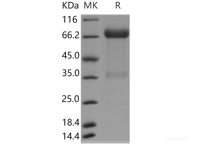 Recombinant Human KIR2DL1 / CD158a Protein (Fc tag)-Elabscience