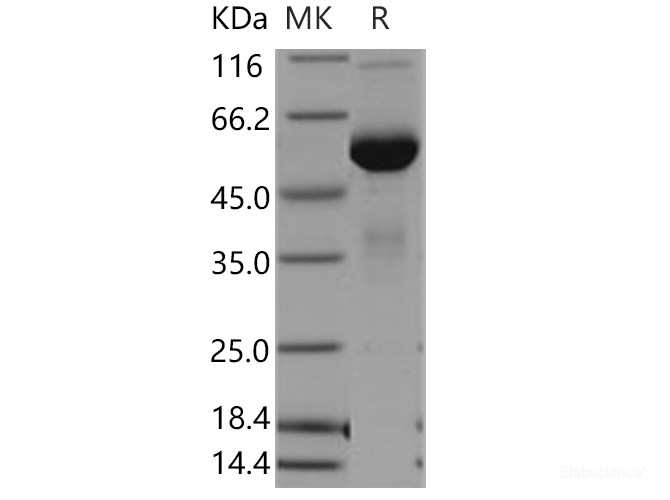 Recombinant Human MSLN / Mesothelin Protein (Fc tag)-Elabscience