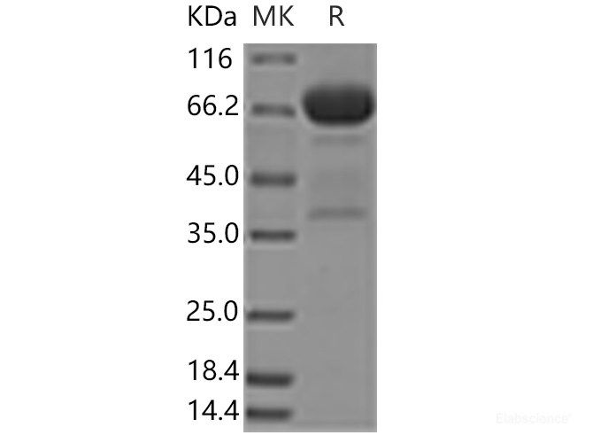 Recombinant Human MSLN / Mesothelin Protein (aa 296-580, Fc tag)-Elabscience