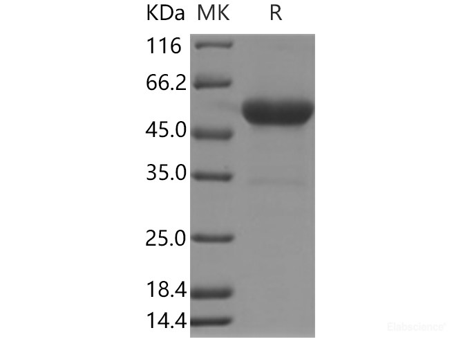 Recombinant Human OX-40L / TNFSF4 / CD252 Protein (Fc Tag)-Elabscience