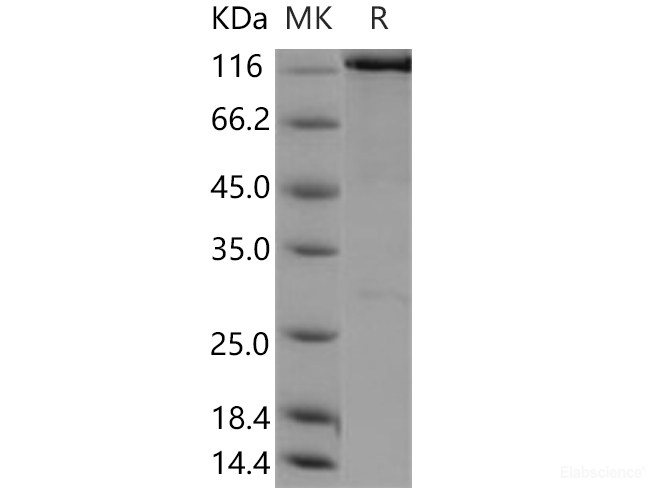 Recombinant Human WWP2 Protein (His & GST tag)-Elabscience
