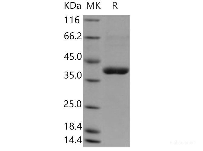 Recombinant Human CANT1 Protein (His tag)-Elabscience