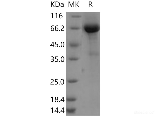 Recombinant Human CANT1 Protein (Fc tag)-Elabscience