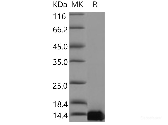 Recombinant Human TFAP2C / AP2-GAMMA Protein (His tag)-Elabscience