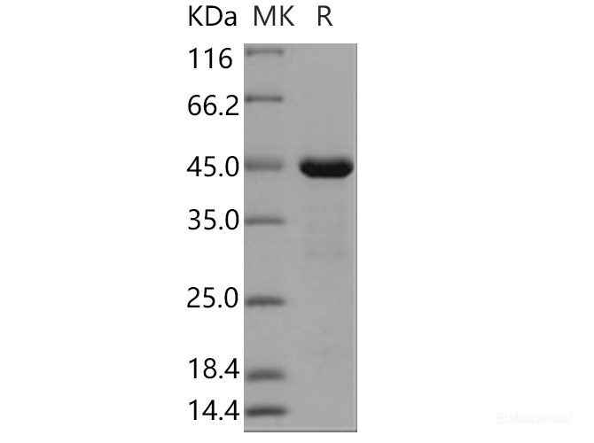 Recombinant Human PRL-2 / PTP4A2 Protein (GST tag)-Elabscience