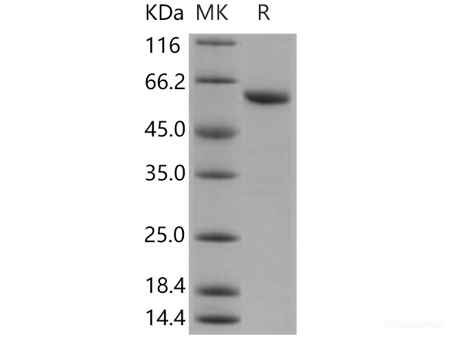 Recombinant Human TXNRD1 / TRXR1 Protein (aa 161-647, His tag)-Elabscience