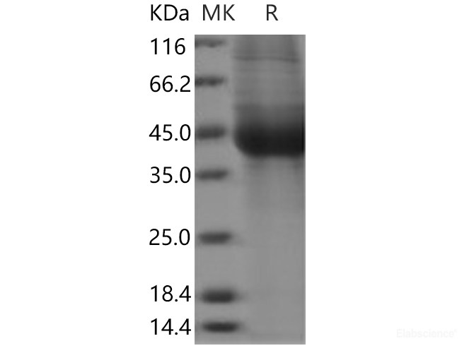 Recombinant Human IL17BR / IL17RB / IL-17 Receptor B Protein (His tag)-Elabscience