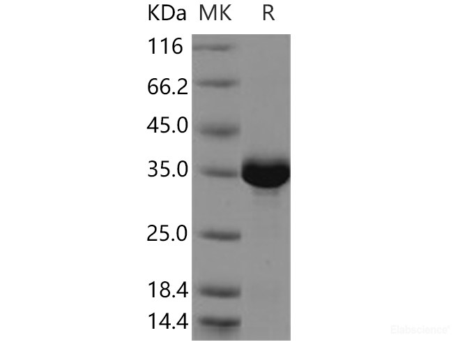 Recombinant Human NUDT5 / ADP-sugar Pyrophosphatase Protein (His tag)-Elabscience