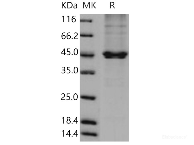 Recombinant Human PON3 / Paraoxonase 3 Protein (50 Ser/Asn, His tag)-Elabscience