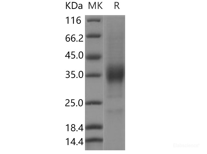 Recombinant Human KIR2DL4 / CD158D Protein-Elabscience