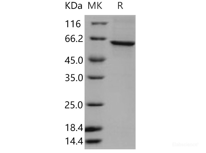 Recombinant Human TERF1 / TRF1 Protein (His tag)-Elabscience