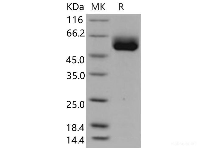 Recombinant Human ST2 Protein (isoform a, His Tag)-Elabscience