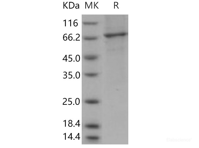 Recombinant Human PDE2A / CGS-PDE Protein (aa 215-900, His tag)-Elabscience