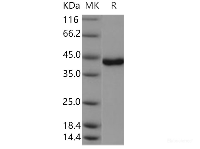 Recombinant Human / Mouse USP46 Protein (N-SUMO)-Elabscience