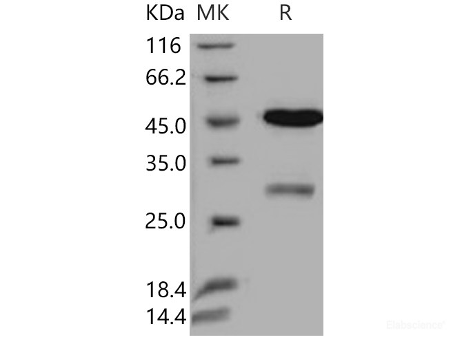 Recombinant Human Uracil-DNA glycosylase / UNG Protein (GST tag)-Elabscience