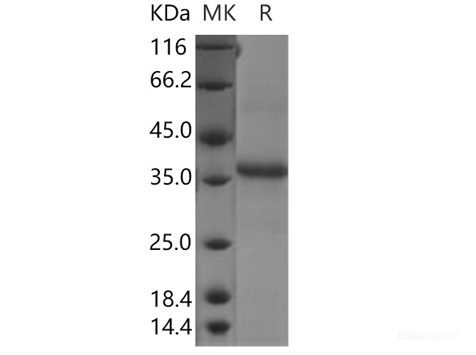 Recombinant Human CLDN11 / Claudin-11 Protein (Fc tag)-Elabscience