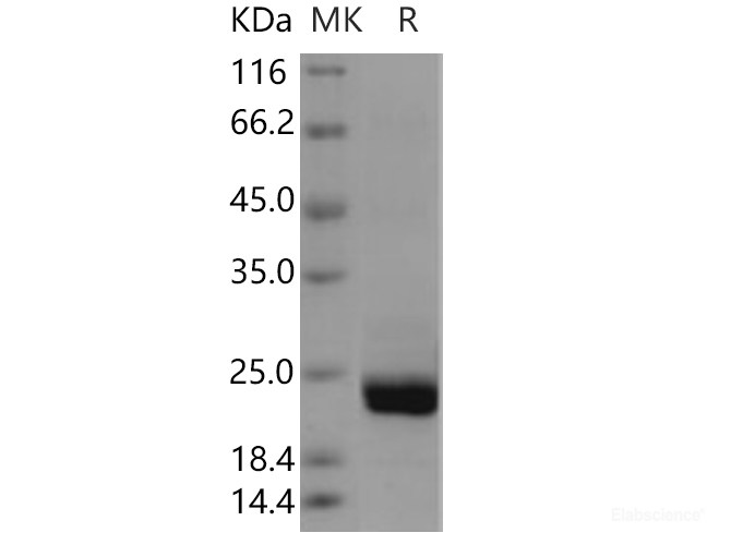 Recombinant Human PTPMT1 Protein (His tag)-Elabscience