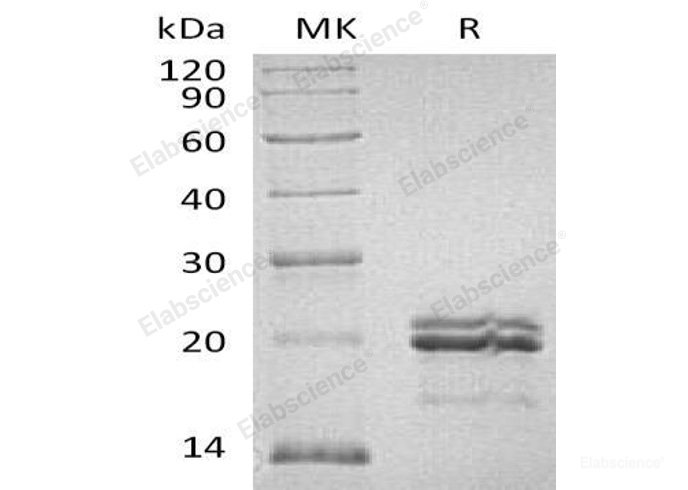 Recombinant Human MAX Protein (His &GST Tag)-Elabscience