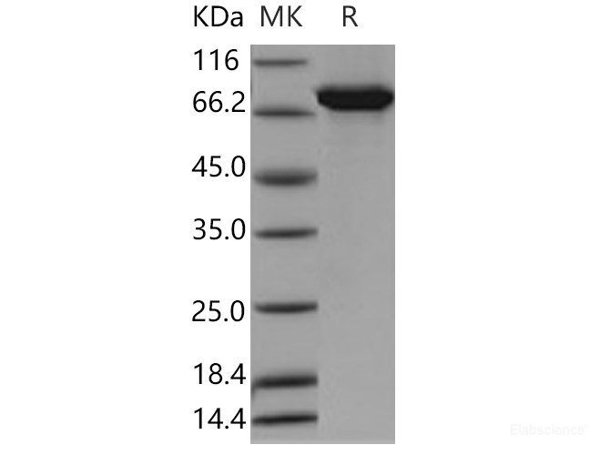 Recombinant Human ALDH4A1 Protein (His & GST tag)-Elabscience