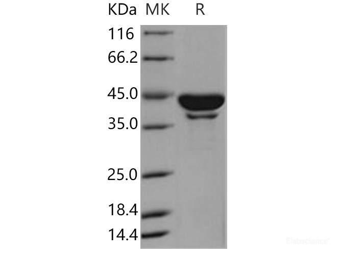 Recombinant Human SerpinB6 / PI-6 Protein (His tag)-Elabscience
