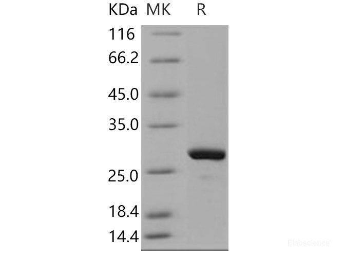 Recombinant Human MAD2L1 / MAD2 Protein (His tag)-Elabscience