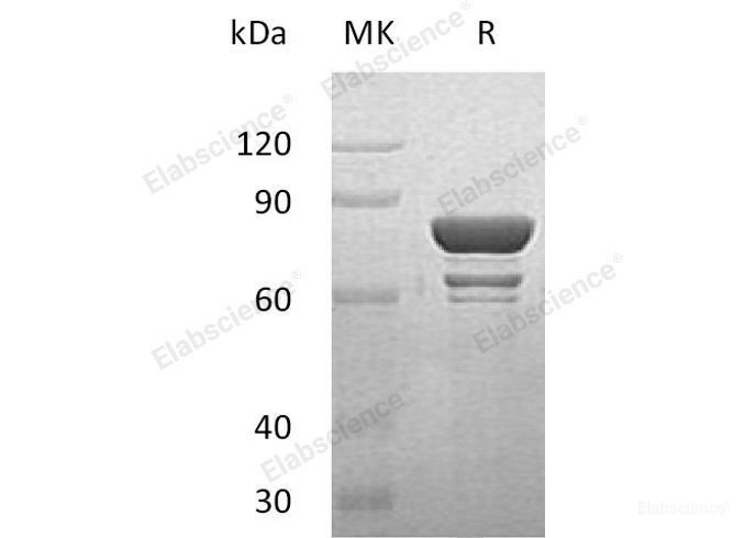 Recombinant Human STAT1 Protein (His &GST Tag)-Elabscience