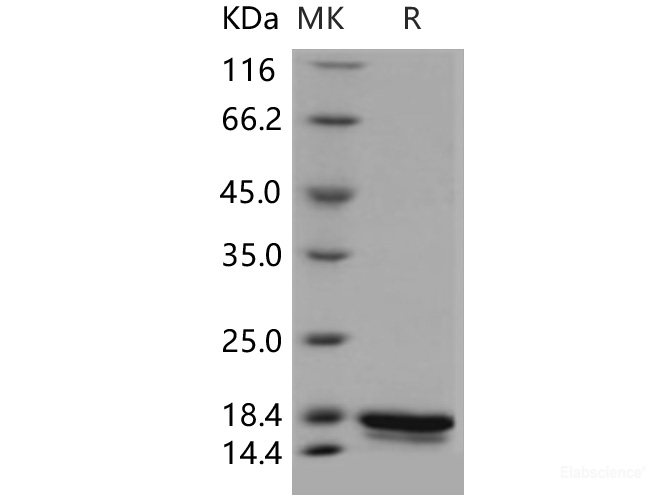 Recombinant Human UBE2W Protein (His tag)-Elabscience